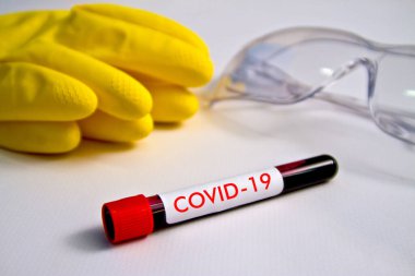 Lastik eldiven ve bardakların arka planında kan örneği var. Örnek Covid-19 yazısıyla birlikte masanın üzerinde..