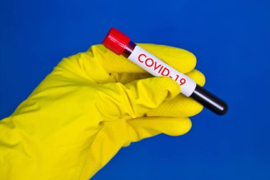 Sarı plastik eldivenler, üzerinde kırmızı kan olan test tüpü, mavi arka planda Covid-19 yazısıyla.