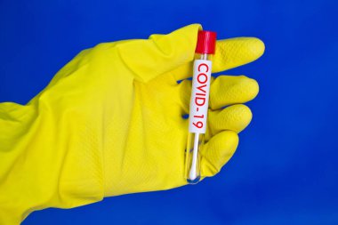 Sarı plastik eldivenler, üzerinde kırmızı kan olan test tüpü, mavi arka planda Covid-19 yazısıyla.