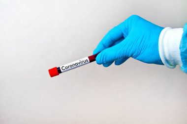 Mavi tıbbi tek kullanımlık eldivenleri teslim edin. Üzerinde kırmızı kan olan test tüpü taşıyın. Üzerinde Coronavirus yazılıydı..