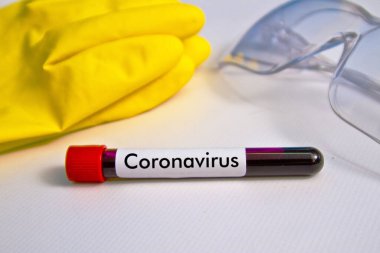 Lastik eldiven ve bardakların arka planında kan örneği var. Örnekler yazıt koronavirüsünün olduğu masada.