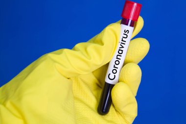 Sarı tıbbi lastik eldivenler, üzerinde kırmızı kan bulunan test tüpü, mavi arka planda Coronavirus yazısıyla birlikte..