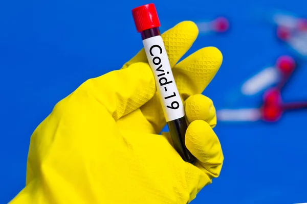 Ands Rubber Gloves Holding Test Tube Blood Inscription Covid — Stock Photo, Image