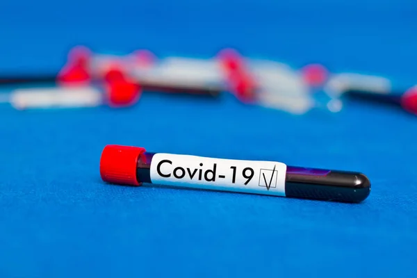 Blood Test Tube Closeup Inscription Covid — Stock Photo, Image