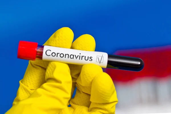 Μπαίνει Λαστιχένια Γάντια Κρατώντας Δοκιμαστικό Σωλήνα Αίμα Την Επιγραφή Coronavirus — Φωτογραφία Αρχείου