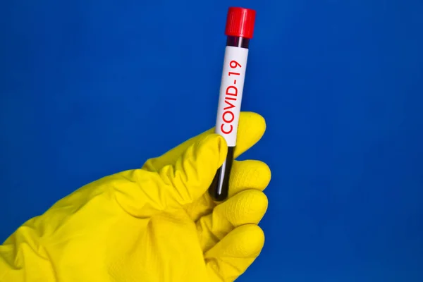 Hand Yellow Medical Rubber Gloves Holding Test Tube Red Blood — Stock Photo, Image