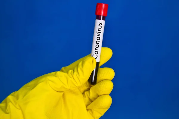 Hånd Gule Medicinske Gummihandsker Holder Reagensglas Med Rødt Blod Blå - Stock-foto