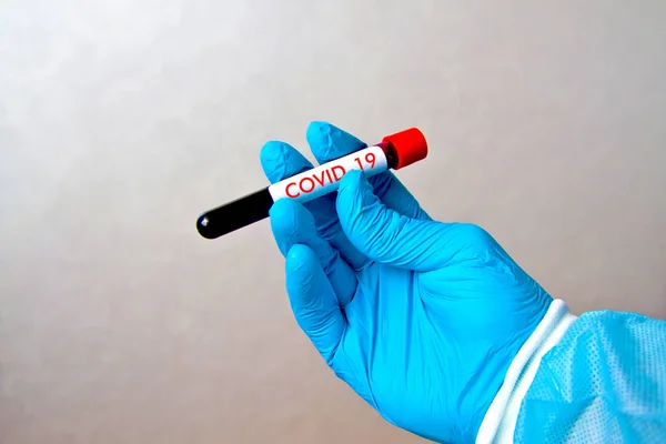Hand Hand Blaue Medizinische Einweg Gummihandschuhe Mit Reagenzglas Mit Rotem lizenzfreie Stockfotos