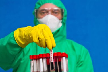 Tulumlu, gözlüklü ve lastik eldivenli bir tıp çalışanı üzerinde Coronavirus yazan bir test tüpü tutuyor..