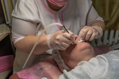 Lazer yüz temizleme işlemi yaşlı bir kadın için yapılır. Derinin yüzeyinde enstrümantal bir etki var. Deri turgor, yenilenme ve iyileşme.
