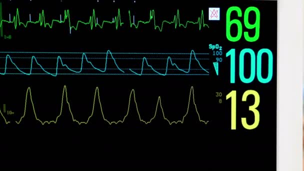 Monitor in ICU with patient in the background — Stock Video