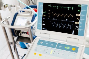 Intra-aortik balon Counterpulsation ve ekstrakorporeal membran oksijenasyonu (Ecmo) yoğun bakımda yaşam belirtileri monitör