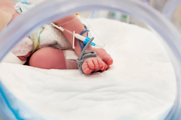 小儿医院新生儿足部脉搏血传感器及点滴线 图库图片