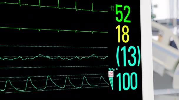 Monitor Signos Vitales Uci Con Paciente Antecedentes — Vídeos de Stock