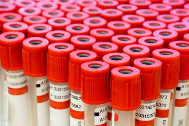 Tıbbi test tüpleri yakın çekim. Sığ Dof atışı.