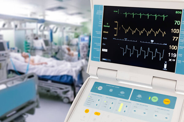 Vital Signs Monitor for Intra-Aortic Balloon Counterpulsation in