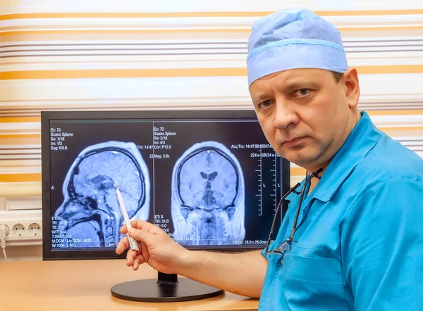 Volwassen dokter onderzoekt een MRI scan van de hersenen — Stockfoto