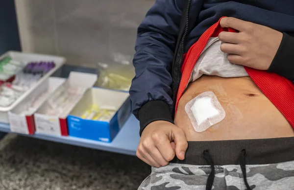 Young teenage boy in hospital. Concept for wound from surgery. — Stock Photo, Image