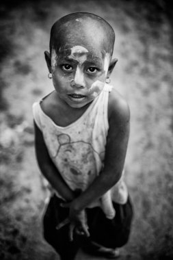 Kel kız kameraya bakıyor