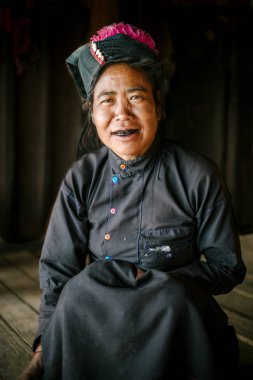 Siyah dişli kameraya gülümseyen kadın