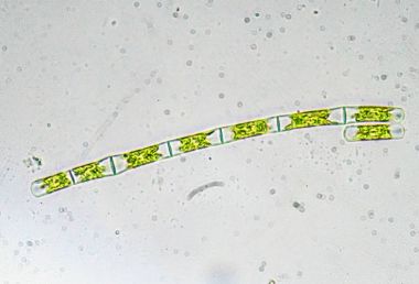 Algae under a microscope. The microscopic world. clipart