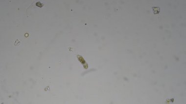 Mikroskop altında ModestMouse bebek. Mikroskobik dünya.