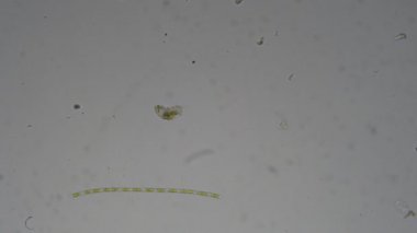 Mikroskop altında ModestMouse bebek. Mikroskobik dünya.