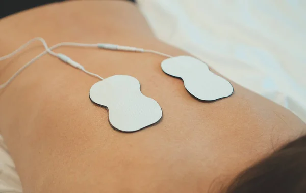Tělo Ženy Elektrodami Zádech Stimulace Elektrického Svalu — Stock fotografie