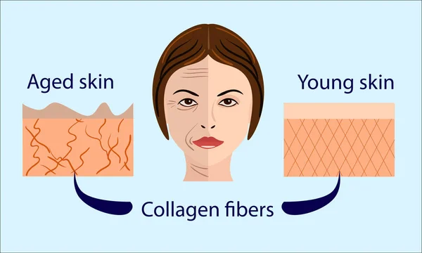 Hautalterung Diagramme. Die junge Haut ist straff, ihr Kollagen-Vektorbild zeigt ein Gesicht und zwei Hauttypen - alt und jung — Stockvektor