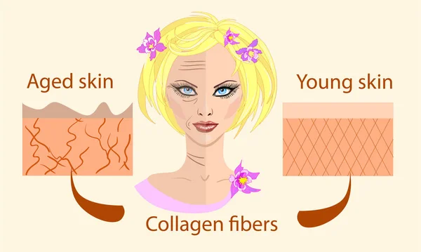 Skin aging diagrams. young skin is firm tight, its collagen Vector illustration with a face and two types of skin — Stock Vector