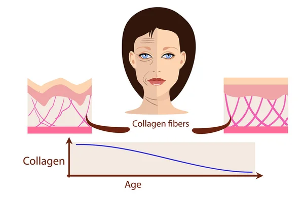 Cara vectorial y dos tipos de piel envejecida y joven para ilustraciones médicas y cosmetológicas — Archivo Imágenes Vectoriales