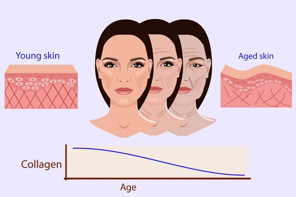Cara vectorial y dos tipos de piel envejecida y joven para ilustraciones médicas y cosmetológicas aisladas — Vector de stock