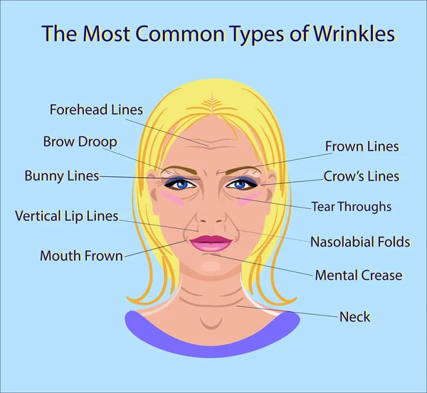 Common Types of Facial Wrinkles. operasi kosmetik. perawatan wajah wanita terisolasi - Stok Vektor