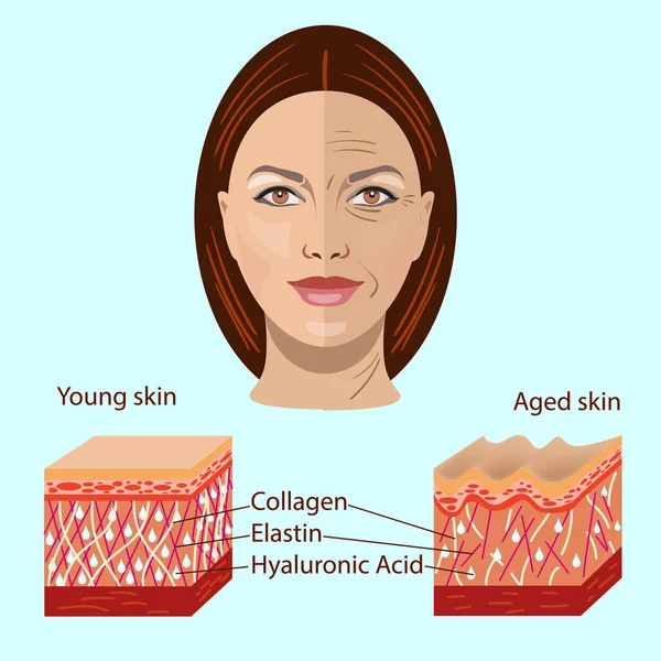 Cara vectorial y dos tipos de piel envejecida y joven para ilustraciones médicas y cosmetológicas — Archivo Imágenes Vectoriales