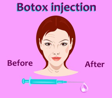 Kozmetik cerrahi vektör çizim. Botox enjeksiyonu. yüz kırışıklık tedavisi.