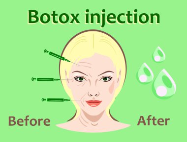 Kozmetik cerrahi vektör çizim. Botox enjeksiyonu. Kadınlar yüz kırışıklık tedavisi.