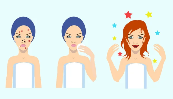 Acne treatment before after, vector illustration — Stock Vector