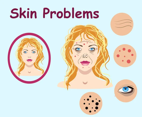 Female face skin problems. Vector illustration for cosmetic — Stock Vector