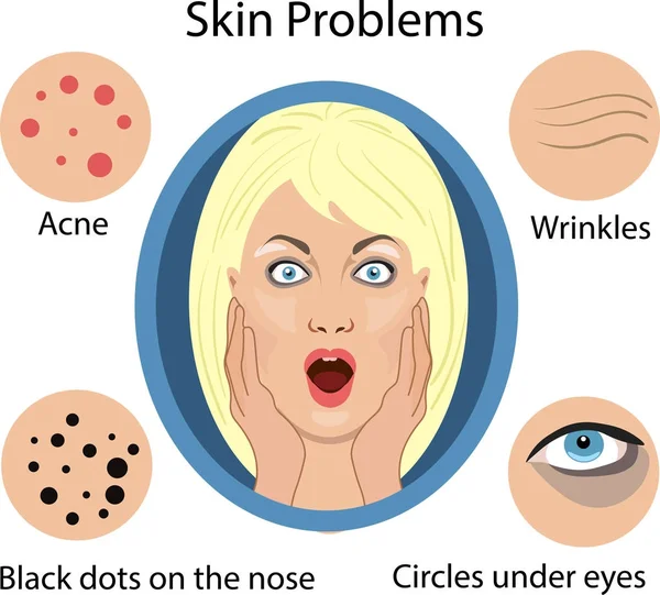 Problemas de piel de cara femenina. Ilustración vectorial para cosméticos — Archivo Imágenes Vectoriales