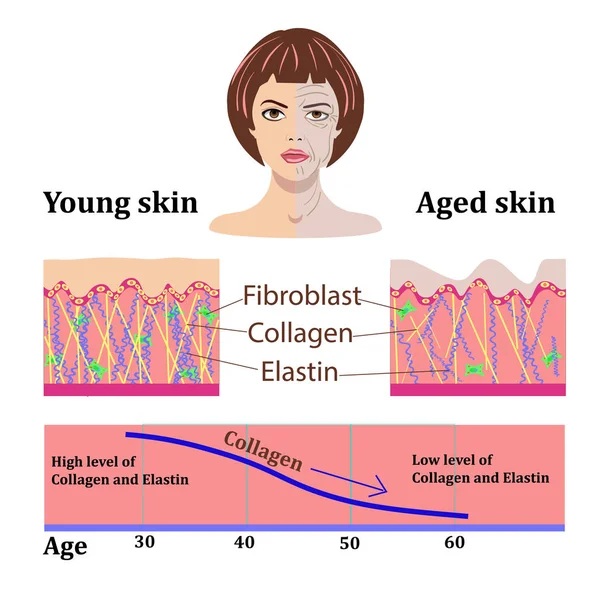 Vektor ansikten och två typer av hud - åldern och ung för medicinska och cosmetological illustrationer isolerade — Stock vektor