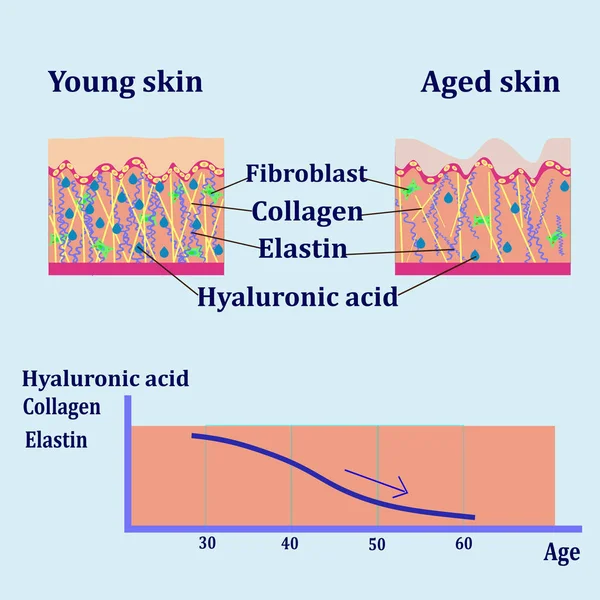 두 가지 유형의 피부, cosmetological 대의 벡터 다이어그램 — 스톡 벡터