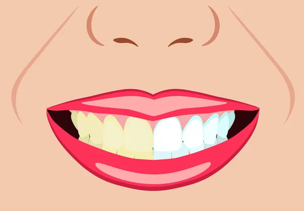 Cara vectorial de niña y sonrisa con dientes malos e ideales para ilustraciones dentales y estomatológicas — Vector de stock