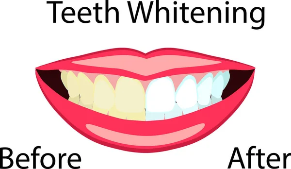 Cara vectorial de niña y sonrisa con dientes blancos malos e ideales para ilustraciones dentales y estomatológicas — Vector de stock