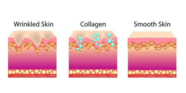 Vektorillustration mit Prozess der Verjüngung der Haut mit Hilfe von Kallogen — Stockvektor