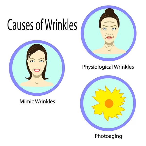 Causes of aging, vector illustration reasons of aging, types of wrinkles on the white background — Stock Vector