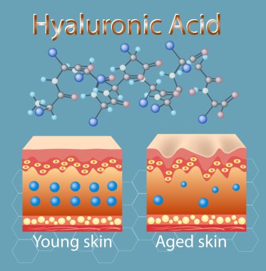 Vector illustration with process of getting skin old because of lack of hyaluronic acid clipart