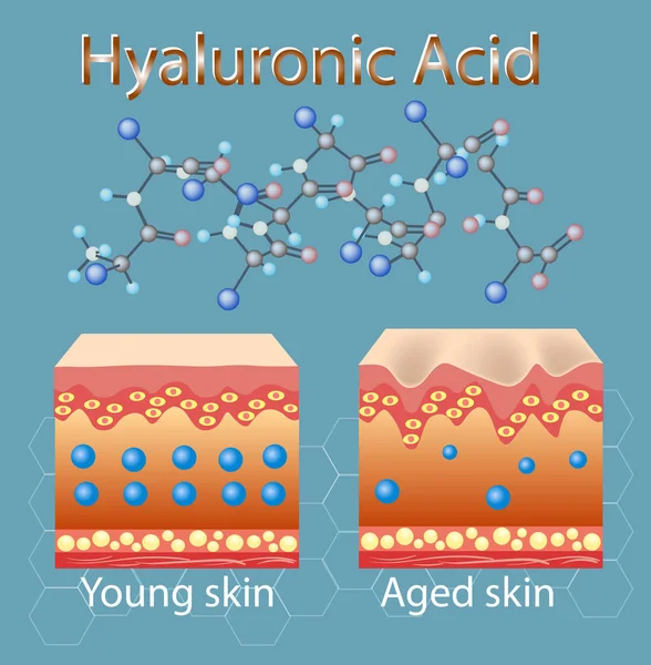 Ilustração vetorial com processo de envelhecimento da pele por falta de ácido hialurônico —  Vetores de Stock
