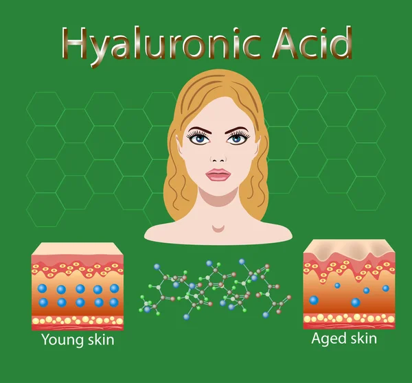 Ilustración vectorial con proceso de envejecimiento de la piel por falta de ácido hialurónico — Vector de stock