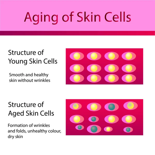 Dos tipos de células de la piel, piel joven y envejecida — Vector de stock