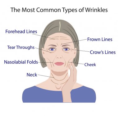 Common Types of Facial Wrinkles. cosmetic surgery. woman facial treatment clipart
